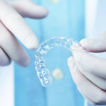 Aligner-von-PlusDental-Copyright-PlusDental