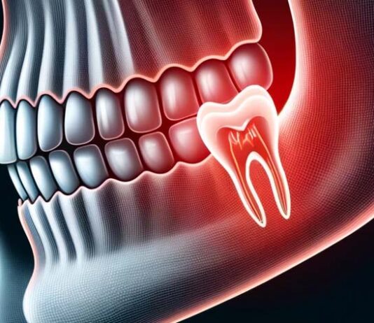 Die stille Epidemie: Wurzelkaries im Fokus der Alterszahnmedizin