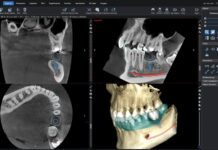 Ausführlicher Überblick und Report zu den aktuellen 3D-Röntgensystemen